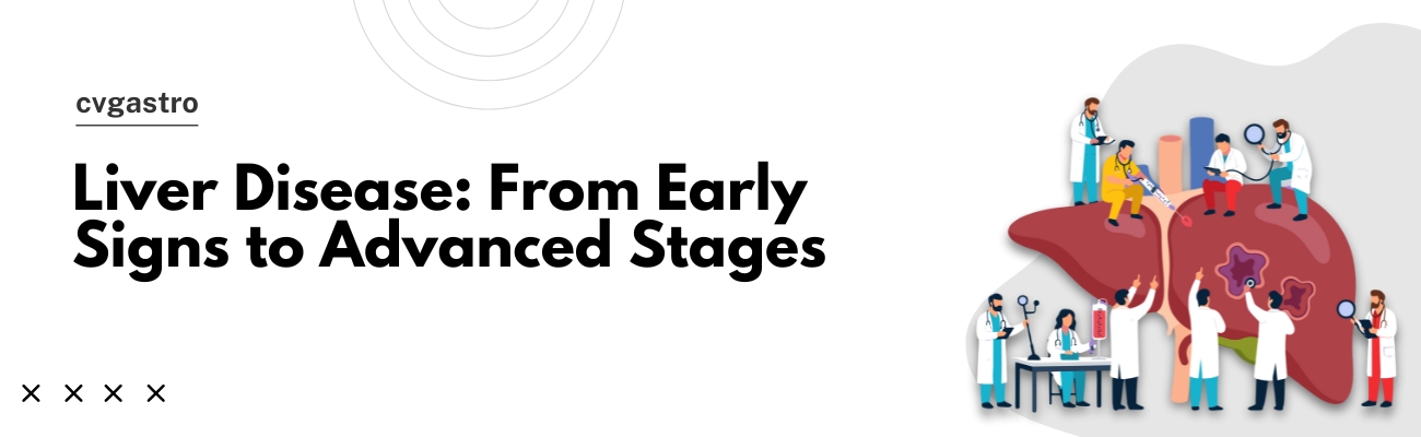 Understanding Liver Disease