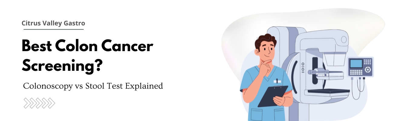 Colonoscopy vs Stool Test Comparison for Colon Cancer Screening
