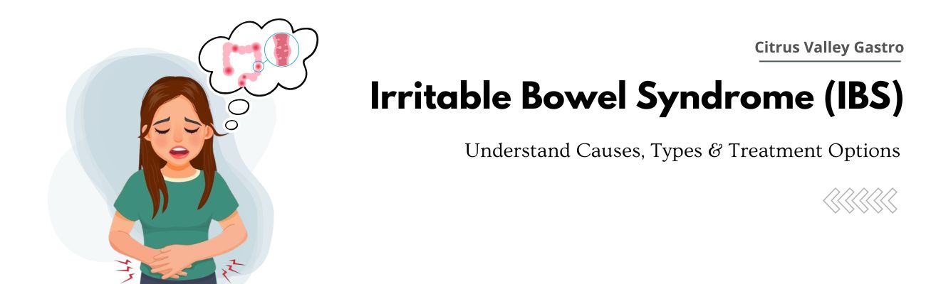 What Is IBS? Breaking Down the Basics of Irritable Bowel Syndrome