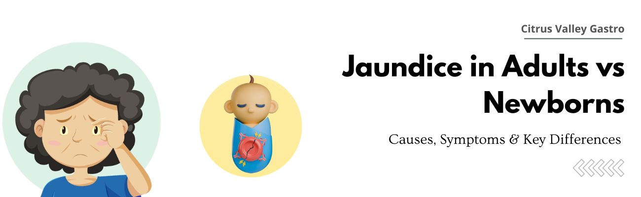 Jaundice in Adults vs Newborns: Causes, Symptoms & Key Differences Explained