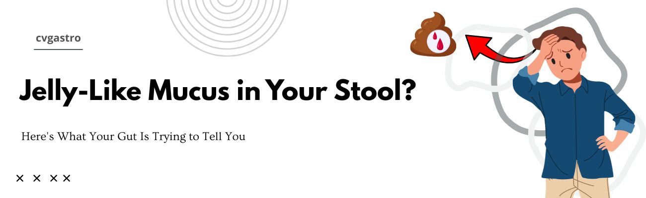 What Causes Mucus in Stool and How Is It Treated?