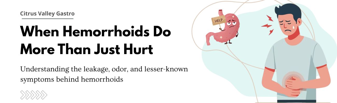 Can Hemorrhoids Cause Leakage and Odor? Symptoms, Causes, and Treatment Options
